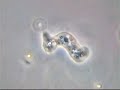 Amoeba