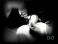 asombroso peligro de cirugia de tetas senos pechos silicona2