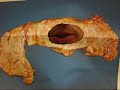 EMTP Pancreas Interview