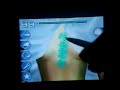 Trauma Center 2 X7: Aletheia XS-rank