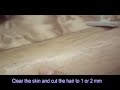 See video