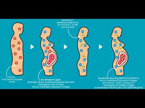 Видео: 1 группа крови: совместимость и характеристика