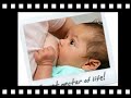 Feeding Tips for Cleft Lip & Palate Cases, Clinical Pediatric Dentistry Feeding Tips for Cleft Lip & Palate Cases, Clinical Pediatric Dentistry