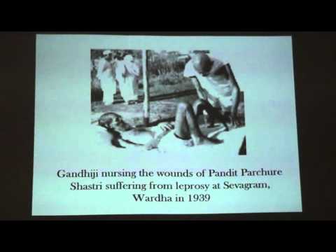 how to treat bcg vaccine