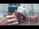 Teeth Whitening : Flossing Teeth With Braces Teeth Whitening : Flossing Teeth With Braces