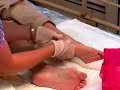 Caring for Pressure Ulcers pt 4 of 4 Caring for Pressure Ulcers pt 4 of 4