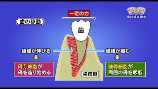 第57回歯の矯正治療