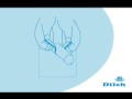 The Dileh Catheter provide the urine adverse current installment, the ventilation protection skin is not infected and a Kink Resistant Nozzle is a silicone, self-adhering, male external catheter designed for maximum wear time. The Clear Advantage features aloe in the adhesive, skin-friendly silicone for constant skin visibility, better breathability and the elimination of skin irritation due to latex sensitivity. It is 100% latex-free and features a kink resistant nozzle designed to eliminate catheter blow offs.