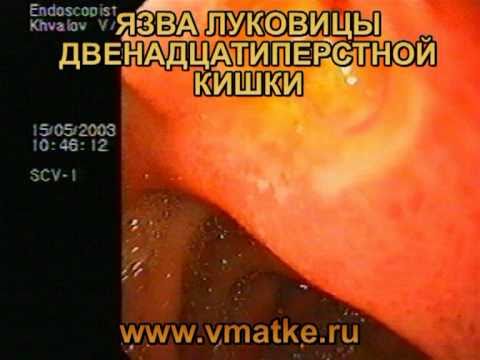 Изменение вылета, ширины и бэдлоки на основе стальных дисков Игрушки своими руками МозгоЧины