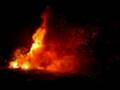 (TINNITUS):SONNENSCHEIN