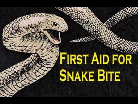 how to provide first aid for snake bites