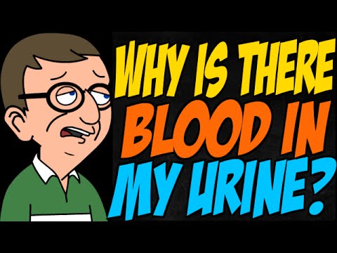 how to dissolve urinary stones