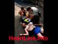 Online CPR Certification American AED Heart Surgery Powerheart