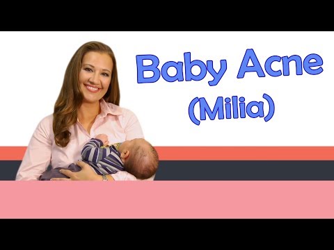 how to help baby acne