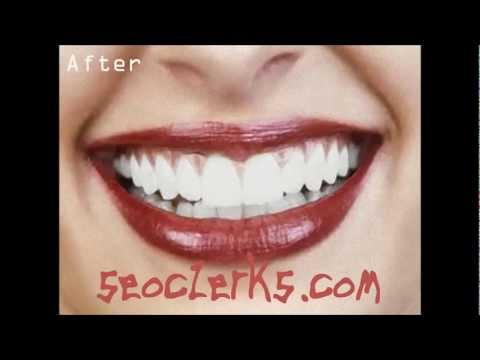how to whiten teeth on photo editor