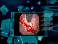 The Endoscopy Evolution