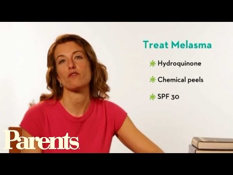 how to care melasma
