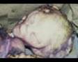 dead-mutilated-Grey-