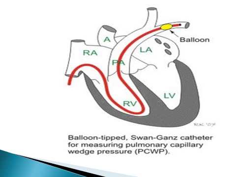 how to measure pulmonary artery pressure