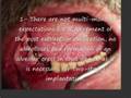 Immediate implantation