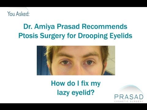 how to cure ptosis naturally