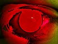 Thumbnail #1