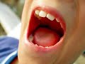 Mouth Explosion Brain