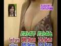 All-Natural Breast Enlargement