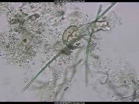 Protozoa