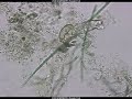 Protozoa