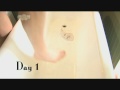 Human Guinea Pigs - Urine Therapy