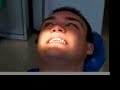 Braces in China (with Neville)
