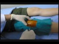 Aspiration Of The Knee Joint Due To Synovium Inflammation Aspiration Of The Knee Joint Due To Synovium Inflammation