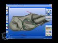 Restauro Canino Discromico con metodologia CAD CAM. Restauro Canino Discromico con metodologia CAD CAM.