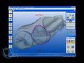 Restauro Canino Discromico con metodologia CAD CAM.