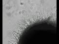 Tissue in media w/ serum 60 hrs