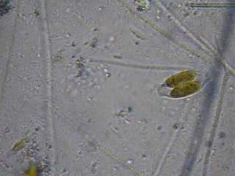 Diatom Encounters Roadblock