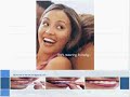Invisalign Slideshow