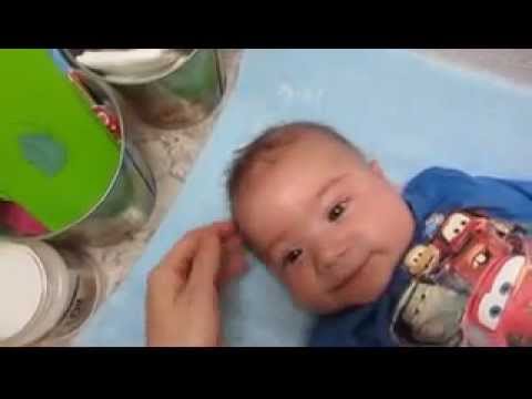 how to remove cradle cap