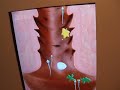 Impregnation - THE GAME (SHOCKING!) Impregnation - THE GAME (SHOCKING!)