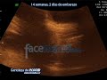 14 Semanas, 2 días de embarazo