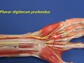Arm Model - Forearm - Flexors - Part 2