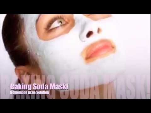 Baking Soda Mask! (Helps with acne)
