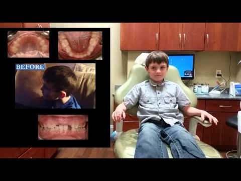 how to cure clicking jaw