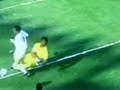 LESÃO GRAVE DO JOGADOR DO SANTOS