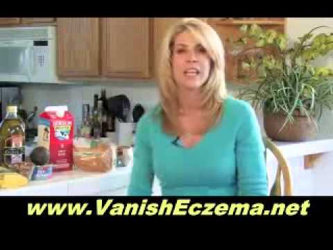 how to get rid of baby eczema