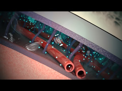 how to treat viral meningitis