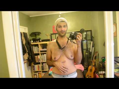 how to know gynecomastia or pseudogynecomastia