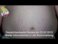ANTI ACTA - PRO PORNO