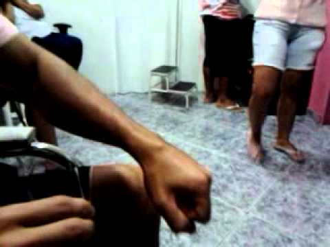 Removendo um cisto sinovial